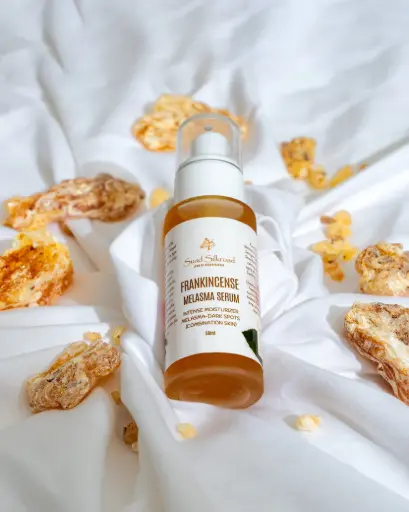 Frankincense Melasma Serum Frankincense Melasma Serum